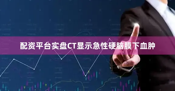 配资平台实盘CT显示急性硬脑膜下血肿
